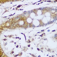 GCC2 antibody