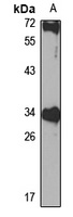 KIR Rabbit Polyclonal Antibody