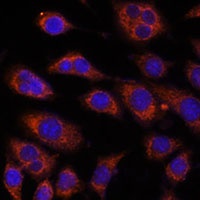 Anti-GFAT2 Antibody