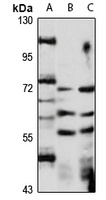 GHR Rabbit Polyclonal Antibody