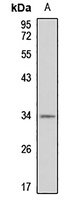 GIPC2 Rabbit Polyclonal Antibody