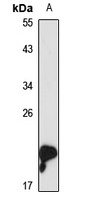 Gastrokine-1 Rabbit Polyclonal Antibody