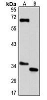 GLOD4 Antibody