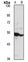GlyR alpha 2 Rabbit Polyclonal Antibody