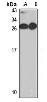 GM2- Rabbit Polyclonal Antibody (AP)