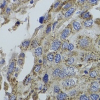 Anti-G alpha 15 Antibody