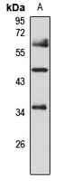 GNAT2 Antibody