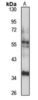 GNAT3 Rabbit Polyclonal Antibody