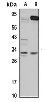 GNPDA2 Rabbit Polyclonal Antibody