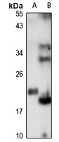 GOLGA7 Antibody