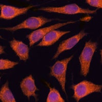Anti-GOLPH3 Antibody