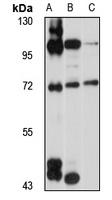 GPATCH2 Antibody