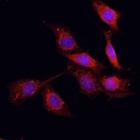 Anti-GPER Antibody