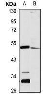 T54 Rabbit Polyclonal Antibody