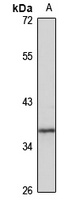 GPR6 Rabbit Polyclonal Antibody