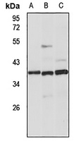 GPR62 Rabbit Polyclonal Antibody
