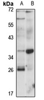 GPR78 Rabbit Polyclonal Antibody