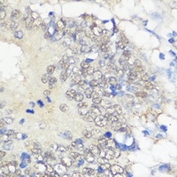 GPx-2 Rabbit Polyclonal Antibody