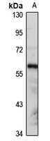 GRB7 Rabbit Polyclonal Antibody