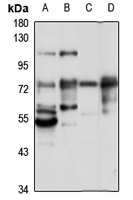 GRK4 Rabbit Polyclonal Antibody