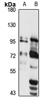 mGLUR2 Rabbit Polyclonal Antibody