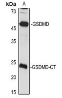 GSDMD-CT Rabbit Polyclonal Antibody