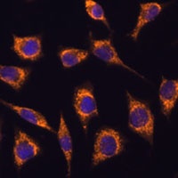 Anti-GSTA3 Antibody