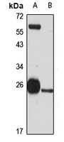 GSTM3 Antibody