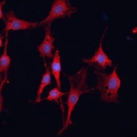 Anti-GSTM3 Antibody
