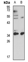 TFIIB Antibody