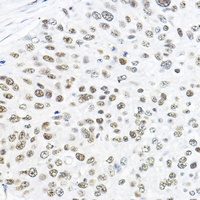 TFIIB Antibody