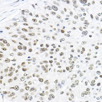 TFIIB antibody