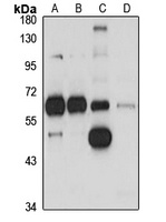TFIIE-alpha Rabbit Polyclonal Antibody