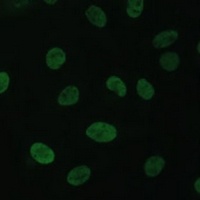 TFIIE-alpha Rabbit Polyclonal Antibody