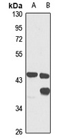 GTF2H2 Rabbit Polyclonal Antibody