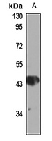 TFIIH 2C Rabbit Polyclonal Antibody
