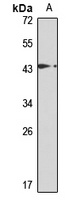 TFIIH 2C Rabbit Polyclonal Antibody