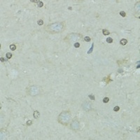 TFIIH 2C Rabbit Polyclonal Antibody