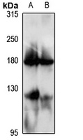 GC-C Rabbit Polyclonal Antibody