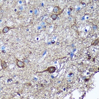 Anti-GULP Antibody