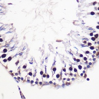 Anti-Histone H2A.V Antibody