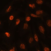 Anti-Histone H2A.V Antibody