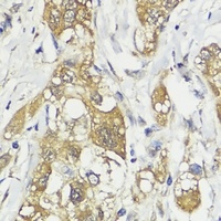 Anti-HACE1 Antibody