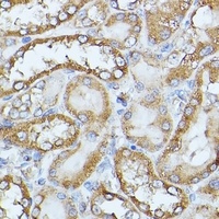 Anti-HAL Antibody