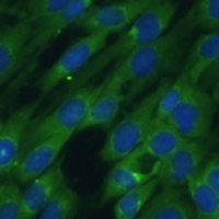 Anti-HAL Antibody