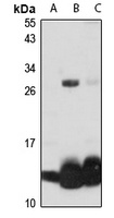 Hemoglobin beta Antibody