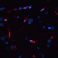 Anti-Orexin Receptor 1 Antibody