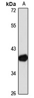 HDAC11 Antibody
