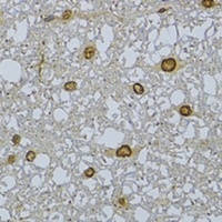 Anti-HDGFRP3 Antibody