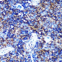 Anti-HEBP2 Antibody